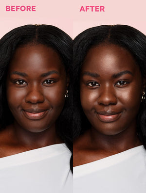 LoveBeam® Perfector