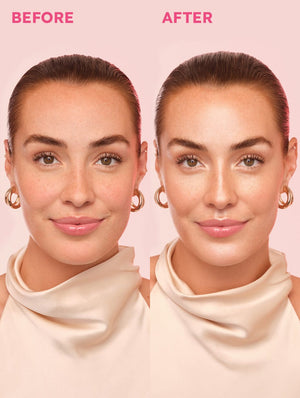 Mini LoveBeam® Perfector